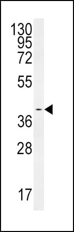 Polyclonal Rabbit anti-Human SMS / Spermine Synthase Antibody (IHC, WB)
