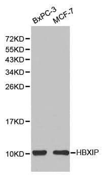 IHC-plus™ Polyclonal Rabbit anti-Human HBXIP Antibody (IHC, WB)
