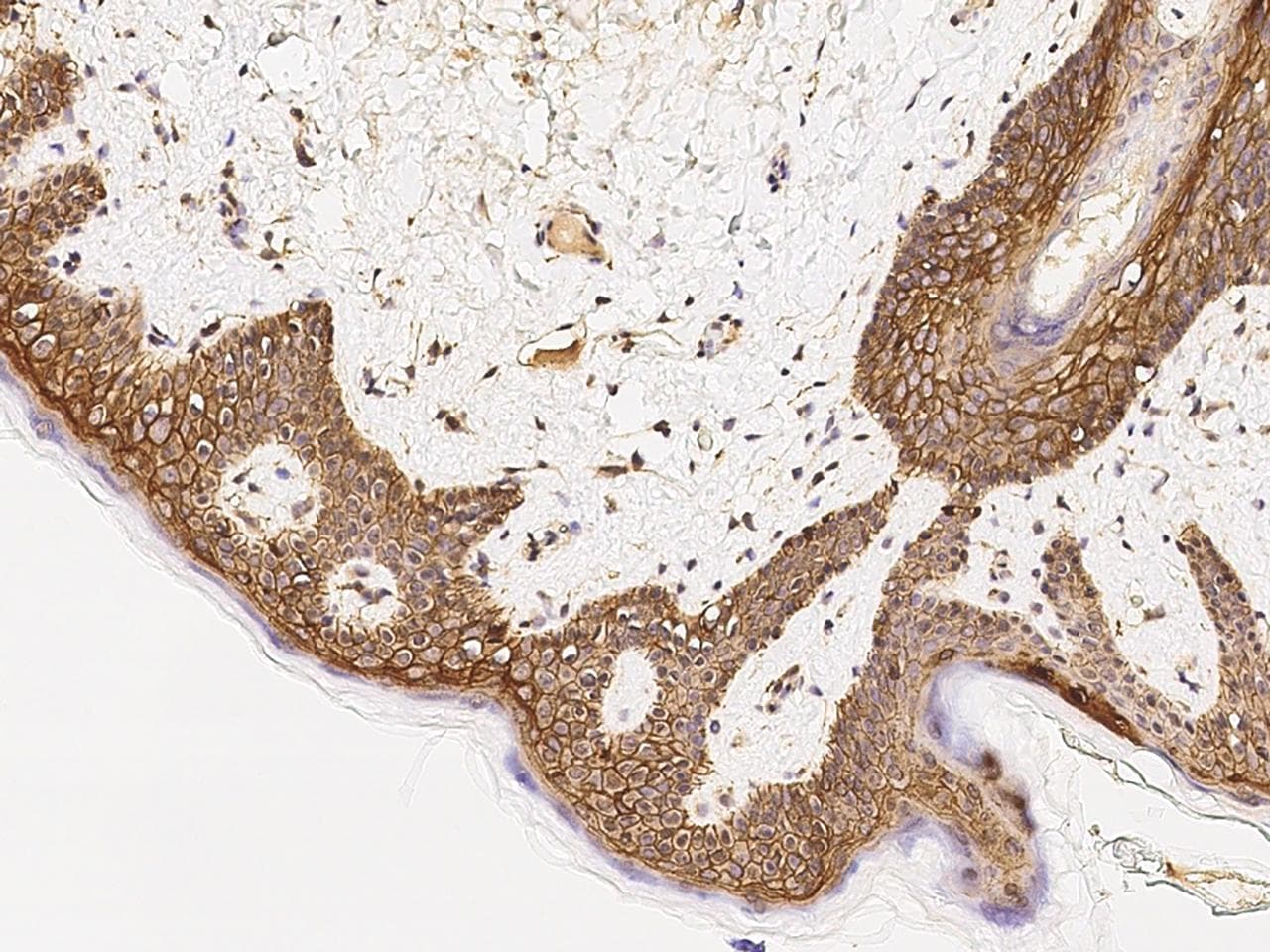 SDC1 / Syndecan 1 / CD138 Antibody (Preservative Free)
