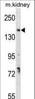 GREB1 Antibody (aa1417-1446)