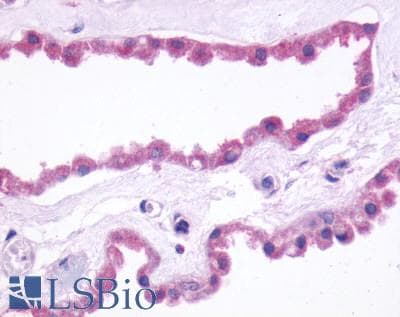 PathPlus™ GRM3 / MGLUR3 Antibody (N-Terminus)
