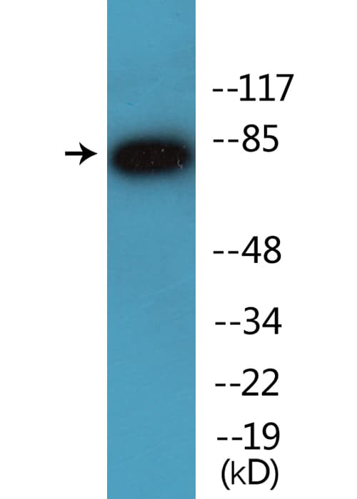 Polyclonal Rabbit anti-Human CHUK / IKKA / IKK Alpha Antibody (phospho-Ser176, IHC, WB)