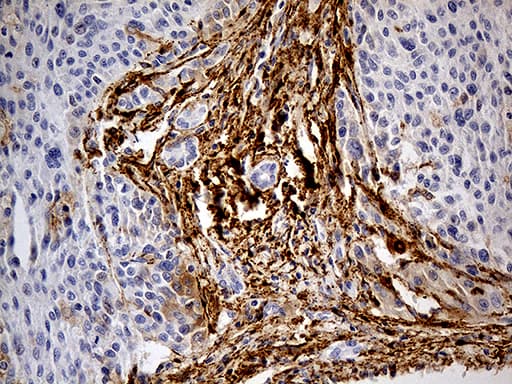 Monoclonal Mouse anti-Human MRC2 / Endo180 Antibody (clone OTI9G4, IHC, WB)