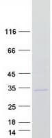 Human KCTD11 Protein (Recombinant Myc-DDK (Flag))