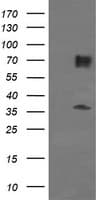 ESRRG / ERR Gamma Antibody (clone OTI5D7)