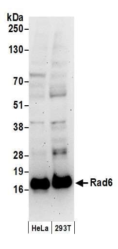 UBE2A Antibody (aa10-50)