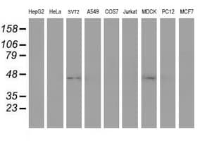 Monoclonal Mouse anti-Human SERPINA5 / PCI Antibody (clone OTI2F2, WB)