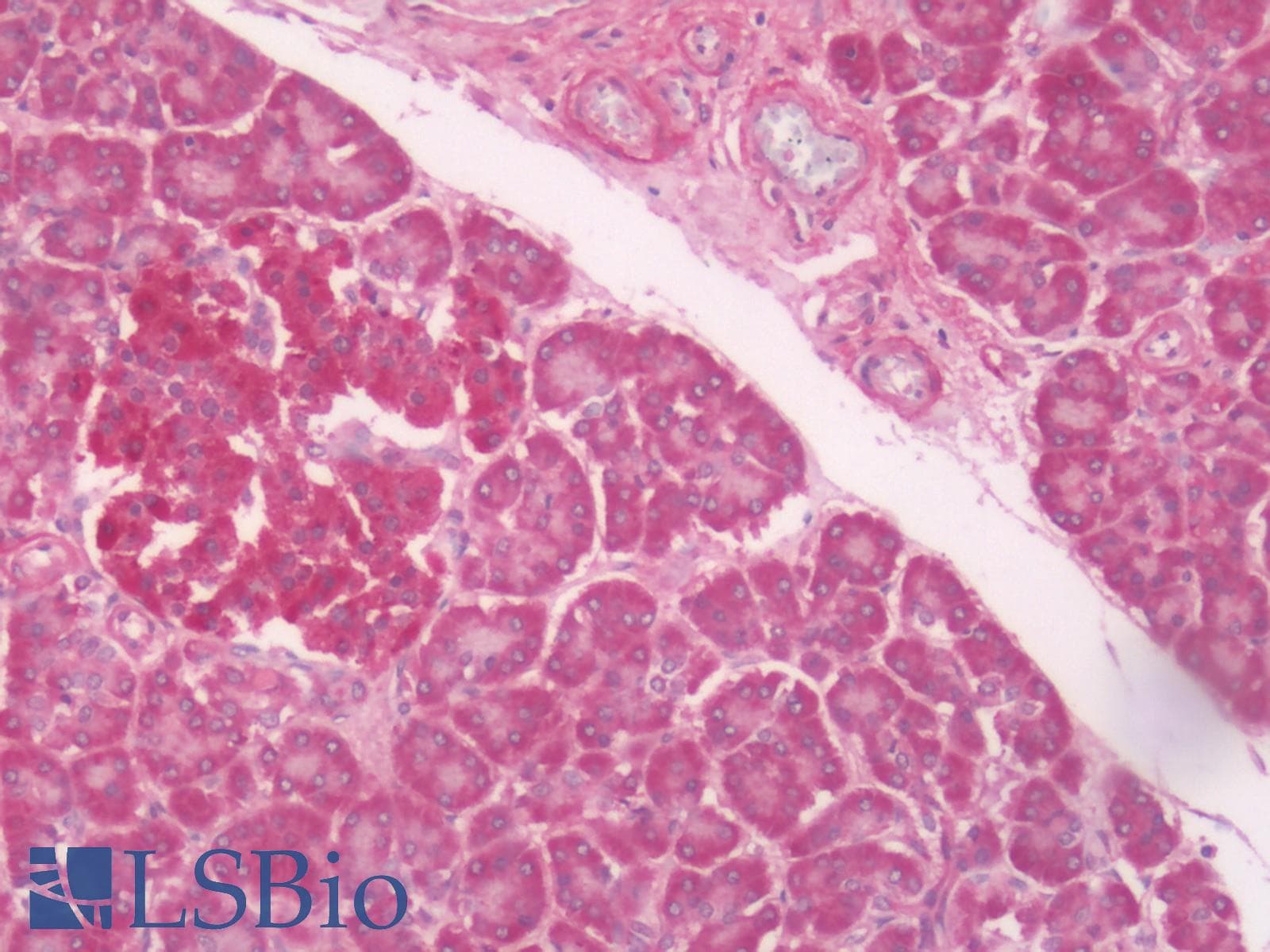 PathPlus™ Polyclonal Rabbit anti-Human LPAR6 / P2RY5 / P2Y5 Antibody (C-Terminus, IHC)