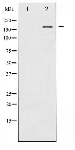 Polyclonal Rabbit anti-Human CML / BCR Antibody (phospho-Tyr177, WB)