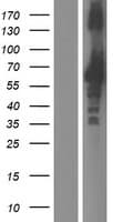 Human ZNF185 Protein (Over-Expression Lysate Myc-DDK (Flag))