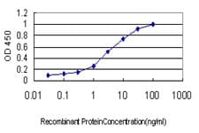 DPYS / Dihydropyrimidinase Antibody (clone 3B1)