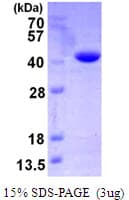 Human VTA1 Protein (Recombinant His)