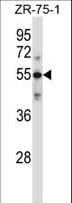 Polyclonal Rabbit anti-Human Complement C9 Antibody (aa191-220, IHC, WB)
