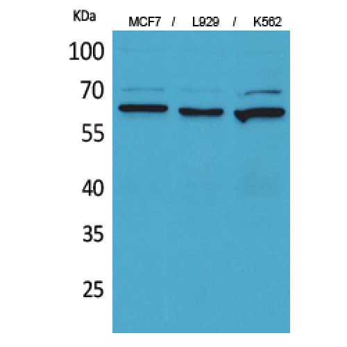 Polyclonal Rabbit anti-Human NT5E / eNT / CD73 Antibody (431-480 aa, Internal, WB)