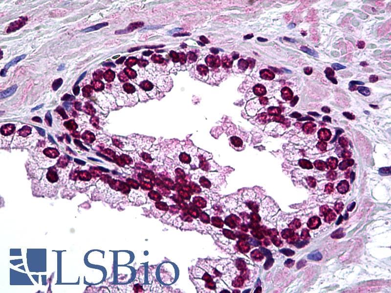 IHC-plus™ DLX2 Antibody (clone 2E12)