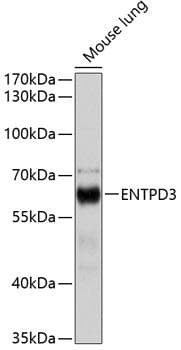 Polyclonal Rabbit anti-Human ENTPD3 Antibody (WB)