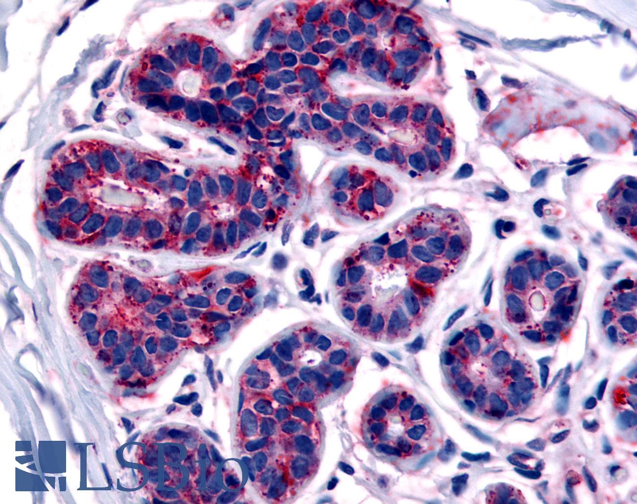 IHC-plus™ Polyclonal Rabbit anti-Human TRB3 / TRIB3 Antibody (N-Terminus, IHC)