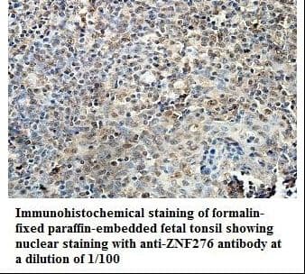 ZNF276 Antibody (aa175-385)