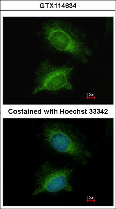 PGM3 Antibody (aa44-321)