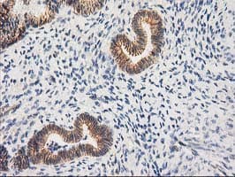 CTNNB1 / Beta Catenin Antibody (clone OTI12H7)