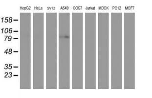 Monoclonal Mouse anti-Human PFKP Antibody (clone OTI3A12, IHC, IF, WB)