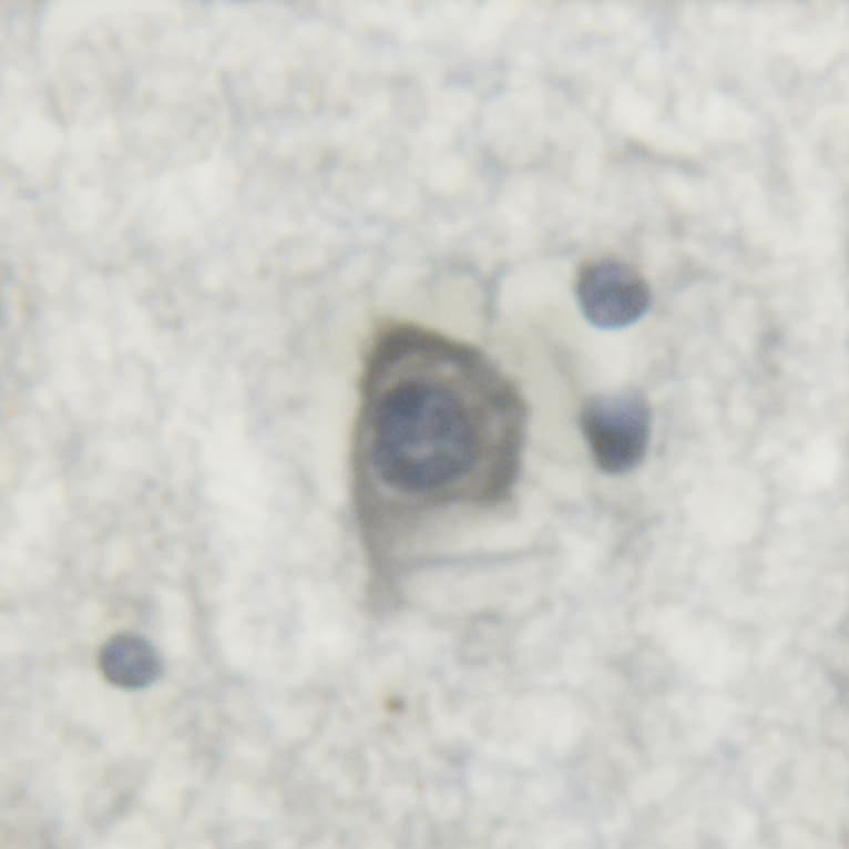IGF1R / IGF1 Receptor Antibody (phospho-Tyr1346)