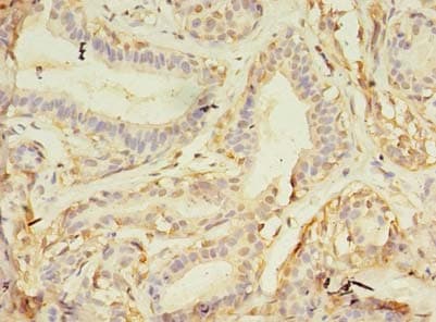 Polyclonal Rabbit anti-Human NAIF1 Antibody (IHC, WB)