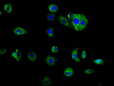 GCK / Germinal Center Kinase Antibody