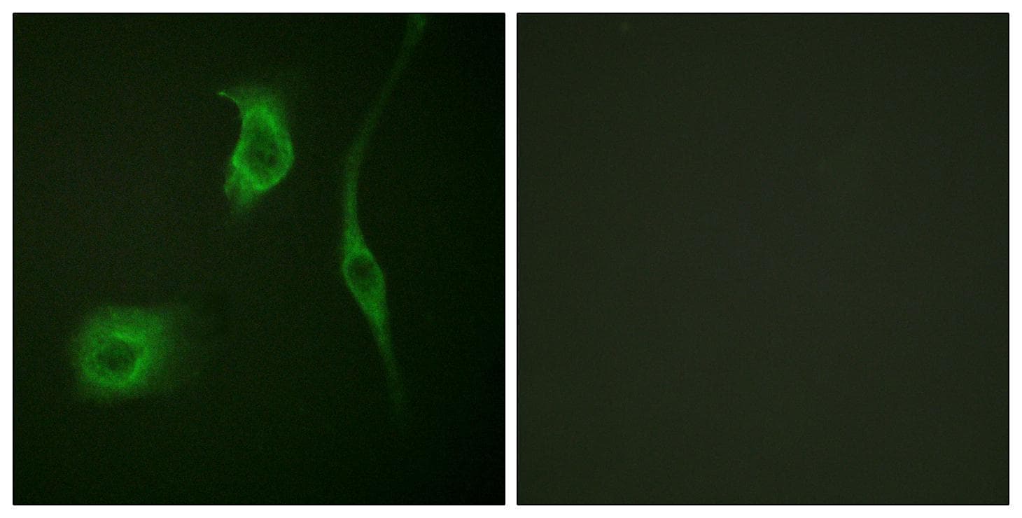 HSPB6 / HSP20 Antibody (phospho-Ser16)