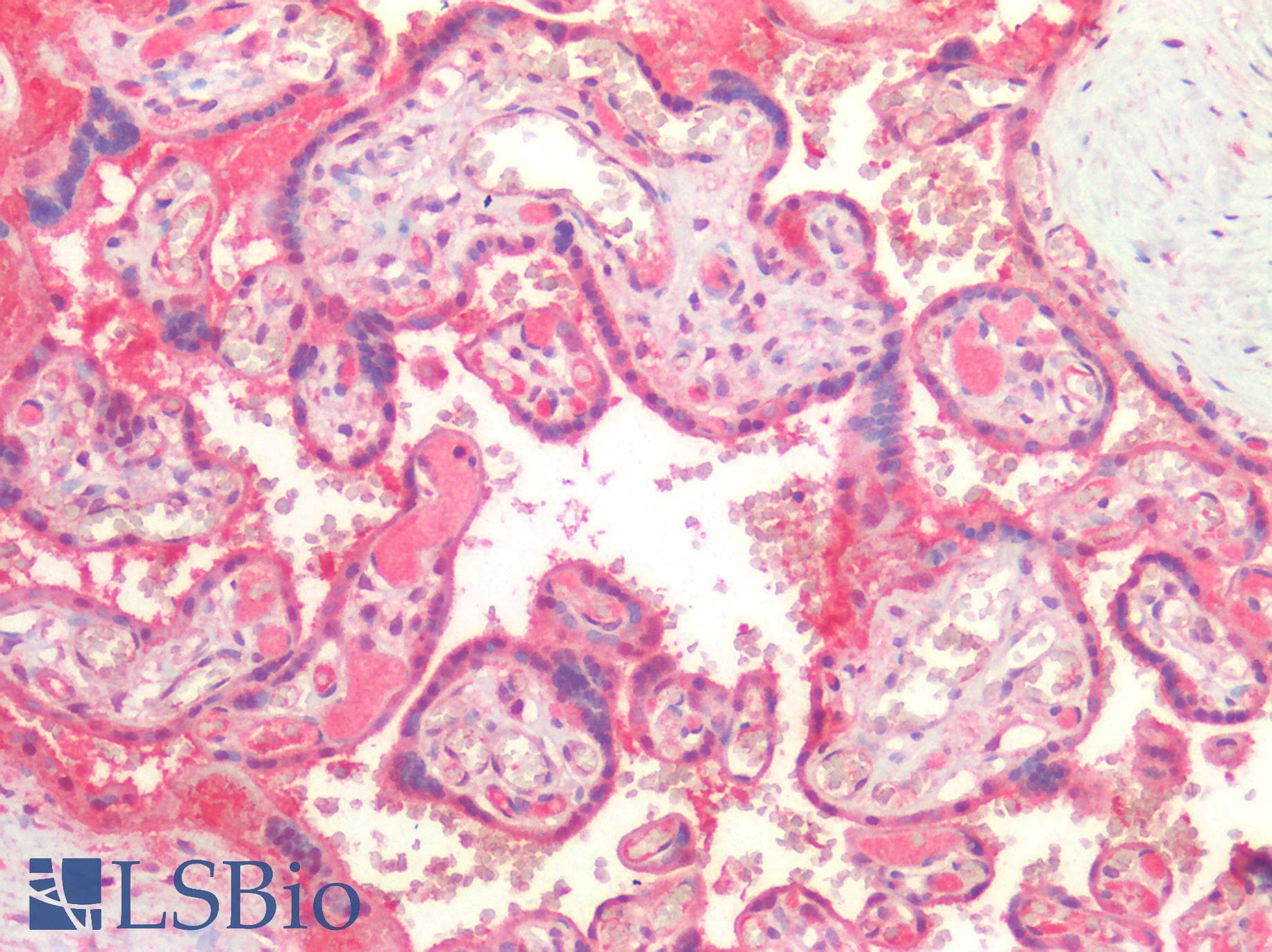 PathPlus™ Polyclonal Rabbit anti-Human CD276 / B7-H3 Antibody (IHC)