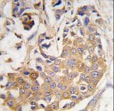 COL9A1 / Collagen IX Antibody (aa428-456)