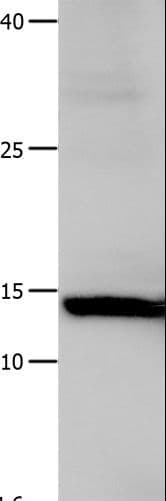 LGALS1 / Galectin 1 Antibody