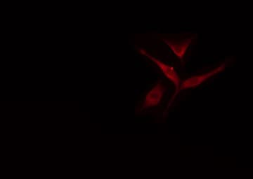 IKZF3 / AIOLOS Antibody