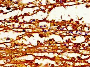 IHC-plus™ ABCB4 / MDR3 Antibody