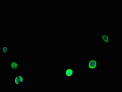 CALR / Calreticulin Antibody