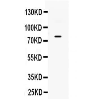 Polyclonal Rabbit anti-Human ADRBK2 / GRK3 Antibody (aa635-669, WB)