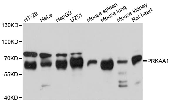PRKAA1 / AMPK Alpha 1 Antibody