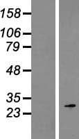 Human ROPN1 / Ropporin Protein (Over-Expression Lysate Myc-DDK (Flag))