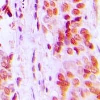 CDKN1C / p57 Kip2 Antibody (N-Terminus)