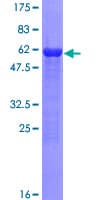 Human KLHL3 Protein (Recombinant GST)