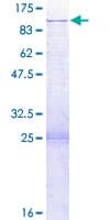 Human SRP68 Protein (Recombinant GST)