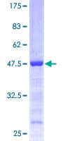 Human EIF1AY Protein (Recombinant GST)