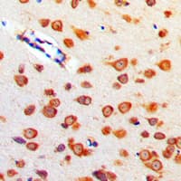 Polyclonal Rabbit anti-Human CBLN4 / Cerebellin 4 Antibody (C-Terminus, IHC, WB)