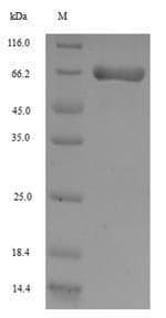 Rat ANPEP / CD13 Protein (Recombinant 6His-SUMO, N-terminus)