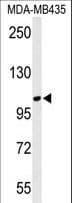 LUZP1 Antibody (aa1042-1070)