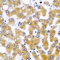 GLUD2 Antibody