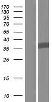 Human GNB1L / FKSG1 Protein (Over-Expression Lysate Myc-DDK (Flag))