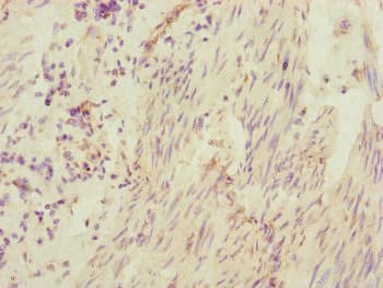 CEP95 / CCDC45 Antibody