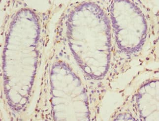 SKAP2 / SCAP2 Antibody