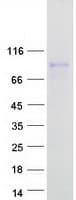 Human CRTC1 / MECT1 / TORC1 Protein (Recombinant Myc-DDK (Flag))